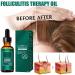 rongweiwang Women Men Dense Hair Growth Essential Oil Adults Follicle Repair Moisturizing Nourishing Essence Haircare Serum - Buy Online on GoSupps.com
