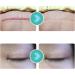 Professional Scar Wrap Tape | UV Protection | Self-Adhesive for Home Use - Buy Online on GoSupps.com