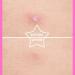 AUSLKA Hydrocolloid Patches (112 Count) - Hydrocolloid Spot Cover - Zit Stickers for Face and Skin Vegan-friendly and Not Tested on Animals 1 count (Pack of 112) - Buy Online on GoSupps.com