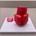 VERIMP Hemorrhoids Teaching Model - Anatomical Hemorrhoid Model for Doctor-Patient Communication & Education - Ideal Anorectal Anatomy Model for Medical Professionals - Buy Online on GoSupps.com
