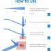2-IN-1 Skin Tag Tool Kit for Men and Women Fast and Easy Micro Skin Tags Skin Tag Tool Kit Painless Skin Tag Kit for Small (2mm) to Medium (8.5mm) Skin Tags - Safe for Most Parts - Blue - Buy Online on GoSupps.com