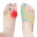 KTSAY Upgraded Bunion Corrector for Women & Men 2 Pcs Non-Surgical Bunion Socks Toe Corrector Comfortable & Breathable for Day/Night Support Hallux Valgus Pain Relief Non-Slip Big Toe Straightener