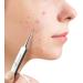 Viamart - Ultra-fine Tweezers - Tweezer - Stainless Steel - Skin Care - Skin Improvement - Removal of Impurities Hairs Pimples Blackheads Splinters and Ticks.