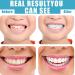 2 Pairs Provisional Tooth Rails & Dentures | Immediate Veneers for Men & Women | Whitening Alternative for Bad Teeth - Buy Online on GoSupps.com