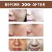 Glutathione Face Cream Freckle Remover Cream Dark Spot Correcting Glow Serum Dark Spot Corrector Correct Black Spots and Brighten the Skin Facial Dark Spots Remover - Buy Online on GoSupps.com