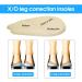Orthopedic Silicone Gel Heel Wedge Insoles - 2 Pairs | Foot Alignment Support for O/X Leg, Bowlegs and Knock Knees - Buy Online on GoSupps.com