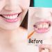 Yinder 100 Pcs Interdental Braces Brushes for Teeth Cleaning - Soft Flossing Heads Dental Tools with Bristles - 6 Colors/Sizes - Buy Online on GoSupps.com