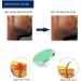 Exfoliating brush to treat And prevent razor bumps And ingrown hairs-including tweezers-eliminate shaving irritation For Face Armpit Legs Bikini line-solution For Men And Women by Silky Skin - Buy Online on GoSupps.com