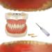 Bovdc teeth model tooth model soft gums complete disassembly learning exercises tooth extraction complete for dentistry or the dentist to communicate with patients