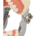 Upper Jaw Cyst Teeth Model - Tooth Preparation & Soft Gums for Pupillary Abscess Incisions | International Shipping - Buy Online on GoSupps.com