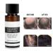 Hair Growth Essence Oil for Men & Women - 20ml Thickening Tonic | Anti Hair Loss & Growth Accelerator - Buy Online on GoSupps.com