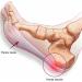 Slimflex Comfort Plantar Fasciitis Insoles for Flat Feet and Heel Pain - Medium Support - 3/4 Length Orthotic Insoles - Buy Online on GoSupps.com