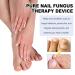 Furzero & Pureail Nail Fungus Laser Devices | Effective Fungal Treatment International Shipping - Buy Online on GoSupps.com
