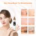 Malkert Blackhead Remover Electric Vacuum with 5 Probes, 3 Suction Models, Hot Compress, USB Rechargeable - For All Skin Types - Includes Comedone Extractor Tool & Mask Brush - Buy Online on GoSupps.com