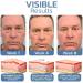 VEMART Awaken Peptide Depuffing Eye Gel for Men - Lifts, Firms, and Reduces Dark Circles - 3pcs - Buy Online on GoSupps.com