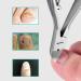 OUHUAN Feet Trimmer Paronychia Nippers Podiatry Stainless - Buy Online on GoSupps.com