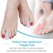 Toe Cushion Hose - Angrek 10 Pairs Silicone Adjustable Toe Caps for Pain Relief & Protection from Ingrown Toenails & Friction - Buy Online on GoSupps.com