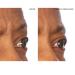 SiO Beauty Mid-Brow Forehead Anti-Wrinkle Patch - Overnight Silicone Patch for Furrows, Expression Lines, and 11s - Buy Online on GoSupps.com