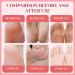 9-Piece Nourishing Foot Mask Niacinamide Foot Mask Callus Cream Foot Socks Moisturising Cream Dry and Cracked Foot Care Callus Removal (Peach + Cherry + Strawberry) - Buy Online on GoSupps.com