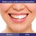 Natural Antioxidant Ao Provantage Dental Gel - Dentist Recommended Oral Care for Healthy Teeth & Gums Soothes Dry Mouth & Sensitive Gums (1PC) - Buy Internationally - Buy Online on GoSupps.com