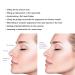 Elves PDO Nose Thread Lift/Nasal 4d COG Pdo Threads for Nose - 19G60mm - Buy Online on GoSupps.com