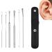 The Most Professional Ear Cleaning Master in 2023 - Ear Cleaner Tool Set Spiral Design Stainless Steel Earwax Removal Kit (Black)