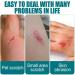 10ML Liquid Dressing: Waterproof Skin Adhesive for Active Skin Repair - Breathable Bandage for Adult & Children - Buy Online on GoSupps.com