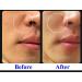 ULTIMATE Retinoid Cream 0.4% | Line Lifting & Rejuvenation Concentrate | 30ml | International Shipping - Buy Online on GoSupps.com