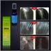 Hair Care Essence - Lanthome Fast Hair Growth & Regrowth Treatment for Men & Women | Anti Hair Loss Chinese Formula - Buy Online on GoSupps.com