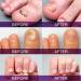 PURE GROWN BY NATURE Pureskin Nail Repair - 1.7 Oz. - Buy Online on GoSupps.com