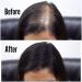 THICK FIBER Hair Fibres (Pack of 1 BLACK) | Powder for Thinning 25g Bottle Makes Thin Look Thicker in Seconds with loss Concealer Women & Men 25 g (Pack of 1) Black - Buy Online on GoSupps.com