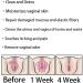 AnnieCare Instant Anti-Itch Detox Slimming Pink Natural Capsules - 1 Box - Revert to Tight and Tender State - Buy Online on GoSupps.com