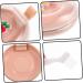 Buy Healeved Storage Box for Prostheses - Orthodontic & Retainer Case | Travel Clip Bag - 10x8.4x2.7cm - Durable ABS Design - Buy Online on GoSupps.com
