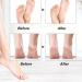 Professional 3pcs Foot Grinder Head Set Exfoliating & Softening Replacement Accessories for Salon & Home Use | Best for Men - Buy Online on GoSupps.com