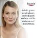 Eucerin Redness Relief Day Lotion SPF 15 - 1.7 fl. oz. - Neutralizes Redness, Protects Skin - Buy Online on GoSupps.com