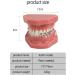 Dental Model Dentist Orthodontic Teeth Demonstration Model Orthodontic Dental Model with Ceramic Brackets and Metal Bracket for Learning Teaching Research - Buy Online on GoSupps.com