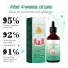 ExqST Gum Rejuvenation Drops - 30 ml | Restore Healthy Gums & Tooth Pockets | Oral Care Solution  - Buy Online on GoSupps.com