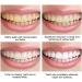 Yanjiayi Bamboo Charcoal Toothpaste - Deep Clean & Whitening (3PCs) | Activated Bamboo Charcoal for Healthy Teeth - Buy Online on GoSupps.com