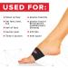 EASYFEET 2023 Arch Support Bands 2pcs Pack - Foot Care Compression for Heel Spurs, Foot Pain Relief & Arch Support - Unisex Braces/Sleeves in 2 Sizes Black - Buy Online on GoSupps.com