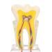 Dental nerve model professional demonstration tooth model for pupils and students for dental teaching - Resin