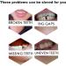 Fake Tooth Repair Kits for Filling The Missing Broken Tooth and Gaps-Moldable Fake Teeth and Thermal Beads Replacement Kits - Buy Online on GoSupps.com
