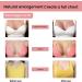 Wukesify Breast Enlargement Oil | 2 PCs 20ml Bust Firming & Lifting Essential Oil for Enhanced Curves and Plumper Breasts - Buy Online on GoSupps.com