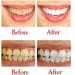 Buy Baking Soda Passion Fruit Whitening Toothpaste | Intensive Stain Removal & Gum Care | Fast International Shipping - Buy Online on GoSupps.com