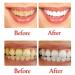 Natural Whitening Toothpaste with Baking Soda - Fluoride-Free Stain Removal & Gum Health (Blueberry Flavor) - International Shipping Available - Buy Online on GoSupps.com