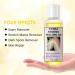 Peeling Oil 110ml Yellow Peeling Oil Skin Peeling Oil Skin Peeling Solution Exfoliatings Extra Strength Whitening Yellow Peeling Oil Removal Exfoliatings Peeling Solution For Body All Skin Type - Buy Online on GoSupps.com
