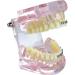 Dental Orthodontic Demonstration Model Dental Teeth Orthodontic Retainer Treatment Model with Metal Self-ligating Brackets Explaining Model - Buy Online on GoSupps.com