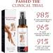 Kolmax Alkyne Psoriasis and Vitiligo Relief Spray - Reduces White Spots on Skin - 3PCS - Buy Online on GoSupps.com