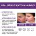 PREMIUM Retinol Serum For Face/Neck/Eyes with Hyaluronic Acid. 8X More Effective Anti Ageing Retinol Serum for Acne Treatment Wrinkles Fine Lines & Sensitive Skin Hydrate & Brighten your look! - Buy Online on GoSupps.com