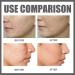 Deep Serum Rice + Alpha-Arbutin Face Serum Serum with Rice Extract and Niacinamide Moisturiser Face Hyaluronic Acid Face Serums Anti Wrinkle Serum Brightening Serum Anti Aging Serum For Face - Buy Online on GoSupps.com