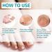 Ingrown Toenail Correction Stickers - Professional Elastic Patch for Curved Toenails - 50PCS - Buy Online on GoSupps.com